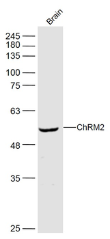 ChRM2 Rabbit Polyclonal Antibody