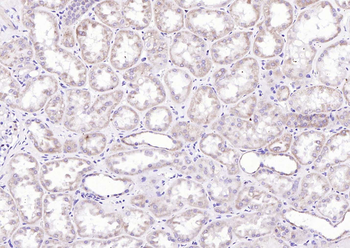 ChRM2 Rabbit Polyclonal Antibody