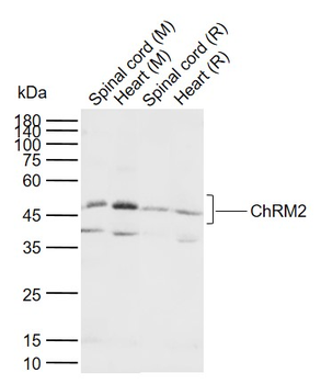 ChRM2 Rabbit Polyclonal Antibody