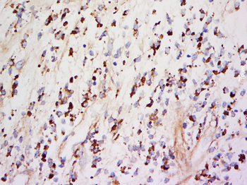 ChRM2 Rabbit Polyclonal Antibody
