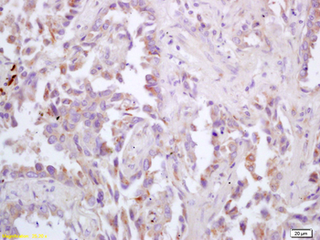 Muscarinic Acetylcholine receptor M3 Rabbit Polyclonal Antibody