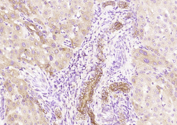 Pan Cytokeratin Rabbit Polyclonal Antibody