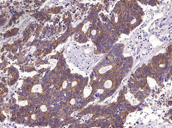 Pan Cytokeratin Rabbit Polyclonal Antibody