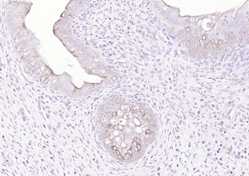 Pan Cytokeratin Rabbit Polyclonal Antibody