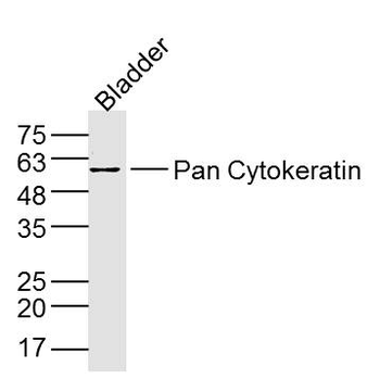 Pan Cytokeratin Rabbit Polyclonal Antibody
