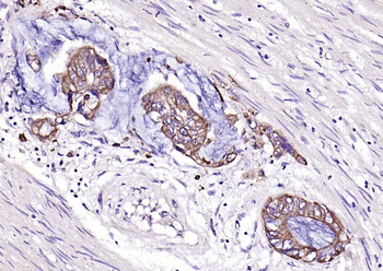 Pan Cytokeratin Rabbit Polyclonal Antibody