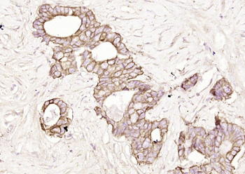 Pan Cytokeratin Rabbit Polyclonal Antibody