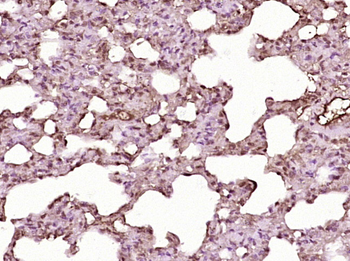 CK16 Rabbit Polyclonal Antibody