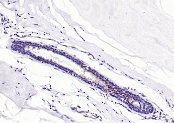 S100A8+A9 Complex Mouse Monoclonal Antibody