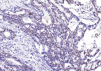 S100A8+A9 Complex Mouse Monoclonal Antibody