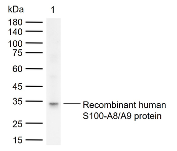 S100A8+A9 Complex Mouse Monoclonal Antibody