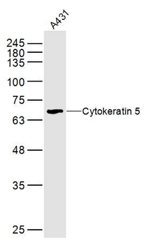 Cytokeratin 5 Rabbit Polyclonal Antibody