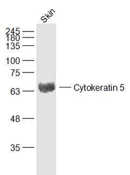 Cytokeratin 5 Rabbit Polyclonal Antibody