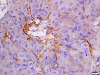 CK7 Rabbit Polyclonal Antibody