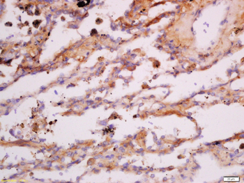 CK7 Rabbit Polyclonal Antibody