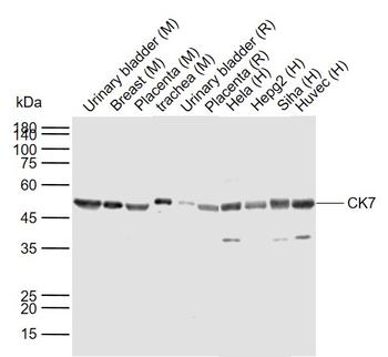 CK7 Rabbit Polyclonal Antibody