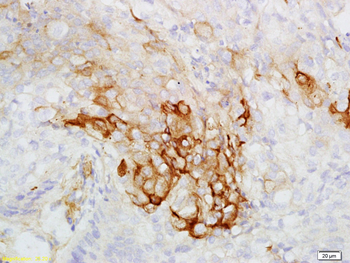 CK7 Rabbit Polyclonal Antibody