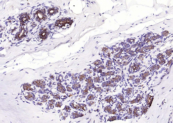 Cytokeratin 8 Rabbit Polyclonal Antibody
