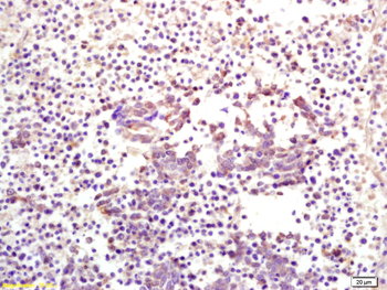 PLEKHO1 Rabbit Polyclonal Antibody