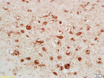 CALB2 Rabbit Polyclonal Antibody