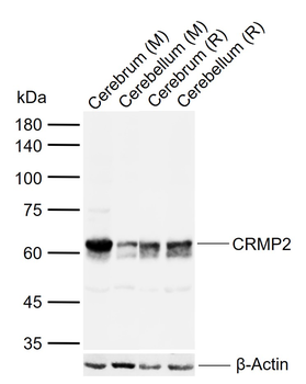 CRMP2 Rabbit Polyclonal Antibody