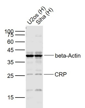 C-reactive protein antibody