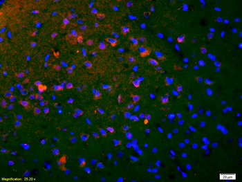 Phospho-CREB-1 (Ser133) Rabbit Polyclonal Antibody