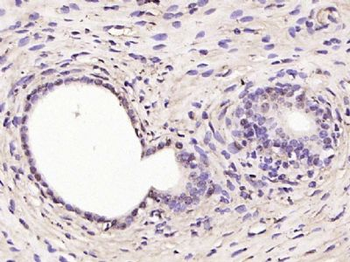 RSL1D1 Rabbit Polyclonal Antibody