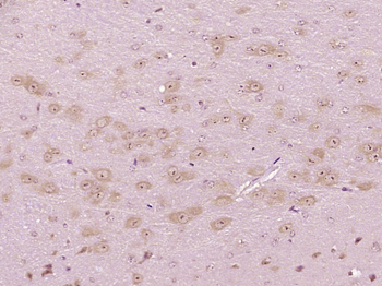 CXorf36 Rabbit Polyclonal Antibody