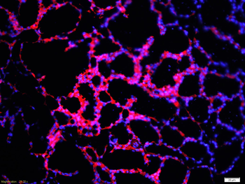 Cyclin D2 Rabbit Polyclonal Antibody