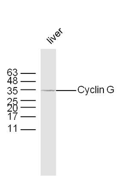 Cyclin G Rabbit Polyclonal Antibody