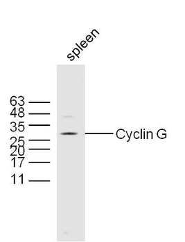 Cyclin G Rabbit Polyclonal Antibody