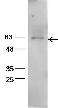 Aromatase Rabbit Polyclonal Antibody