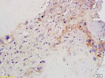 Aromatase Rabbit Polyclonal Antibody
