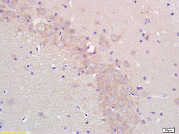 Aromatase Rabbit Polyclonal Antibody