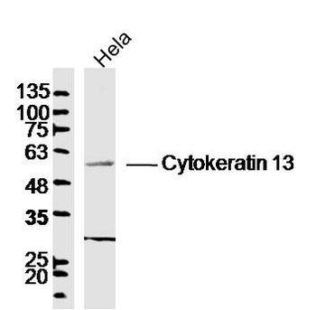 CK-HMW antibody