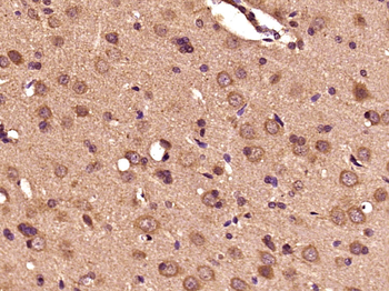 Dopamine beta Hydroxylase Rabbit Polyclonal Antibody