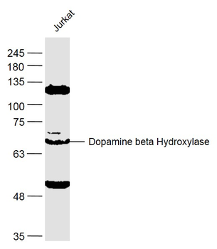 Dopamine beta Hydroxylase Rabbit Polyclonal Antibody