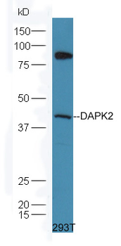 DAPK2 Rabbit Polyclonal Antibody