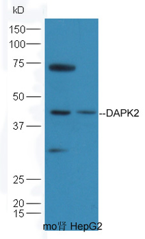 DAPK2 Rabbit Polyclonal Antibody
