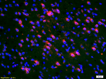 Deltex 1 Rabbit Polyclonal Antibody