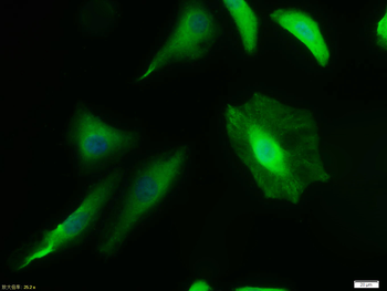 DR5 Rabbit Polyclonal Antibody
