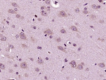DVL1 Rabbit Polyclonal Antibody