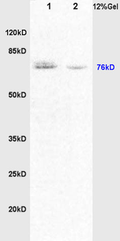 DVL1 Rabbit Polyclonal Antibody