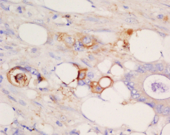DVL1 Rabbit Polyclonal Antibody
