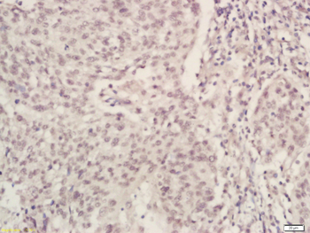 DNA Ligase IV Rabbit Polyclonal Antibody