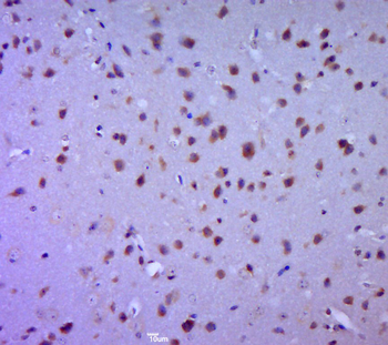 E2F4 Rabbit Polyclonal Antibody