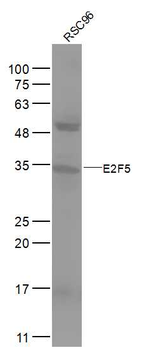 E2F5 Rabbit Polyclonal Antibody