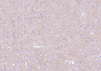 EAAT1 Rabbit Polyclonal Antibody