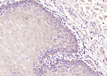 SPINK7 Rabbit Polyclonal Antibody